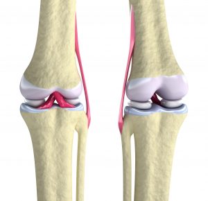 Helpful Pointers for Managing Your Arthritis Pain in Florida
